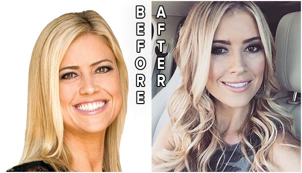 Christina el Moussa before and after lips surgery