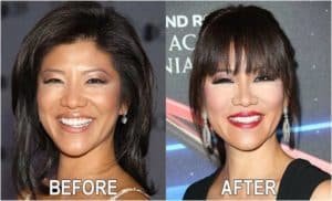 julie chen before plastic surgery Image 7