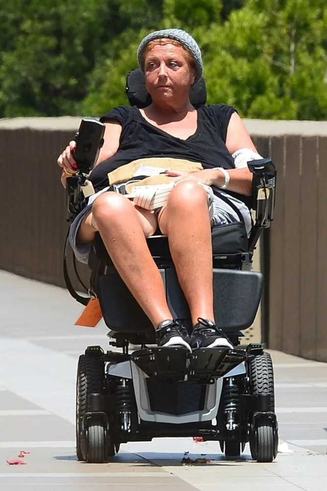 Abby Lee Miller Shared a detailed reflection on her cancer recovery and mobility journey via TikTok.